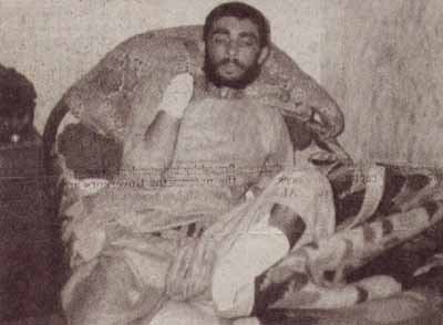 طلعت خان جوان افغان که به اتهام دزدی، دست راست و پای چپش به دستور محکمه اسلامی طالبان در لشکرگاه قطع شده.