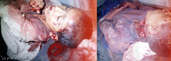 2 boys killed by warlords in Jalalabad