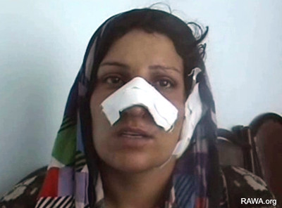 Nafisa's husband cut off her nose and ear
