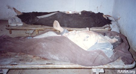 کشته شدگان در شفاخانه جمهوریت Dead bodies in Jamhooriat Hospital